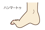 n}[gD